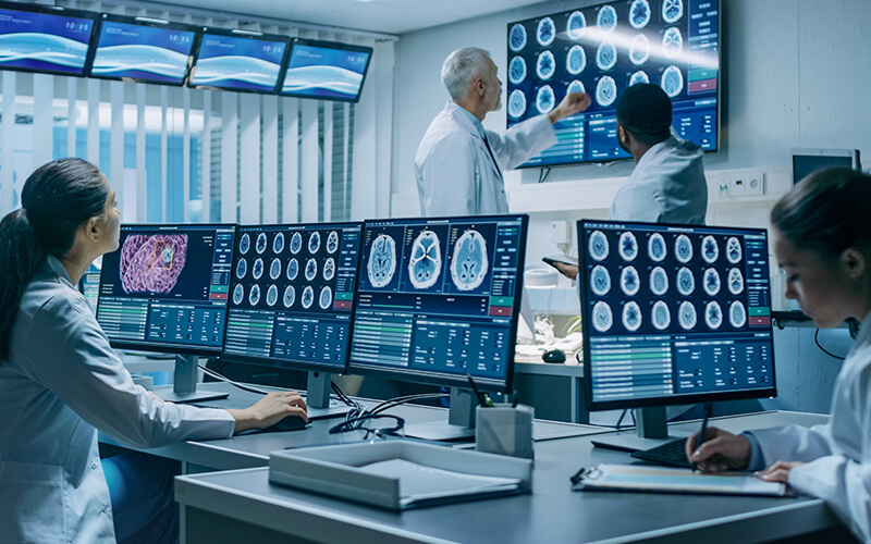 brain mri 